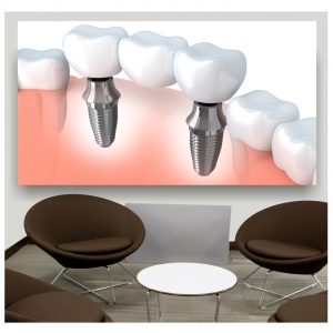 Painel Adesivo Dentista Dentes S215